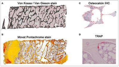 An Optimized Approach to Perform Bone Histomorphometry